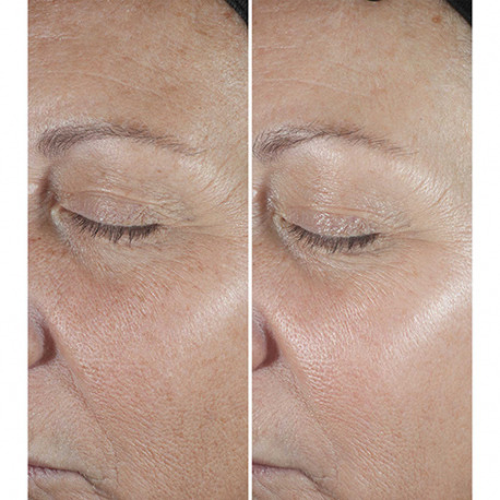CLINIQUE Smart Clinical Repair Serum - Faltenkorrektur-Serum CLINIQUE Smart Clinical Repair Serum - Faltenkorrektur-Serum